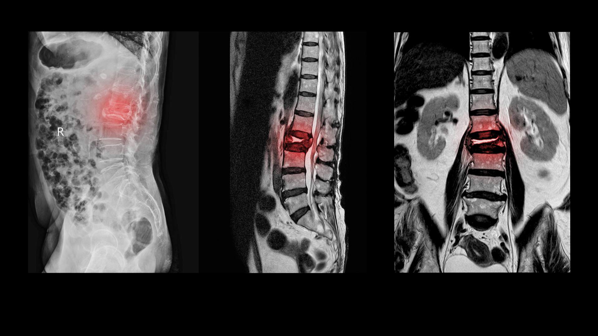 gerincserv-vizsgalat-boritokep